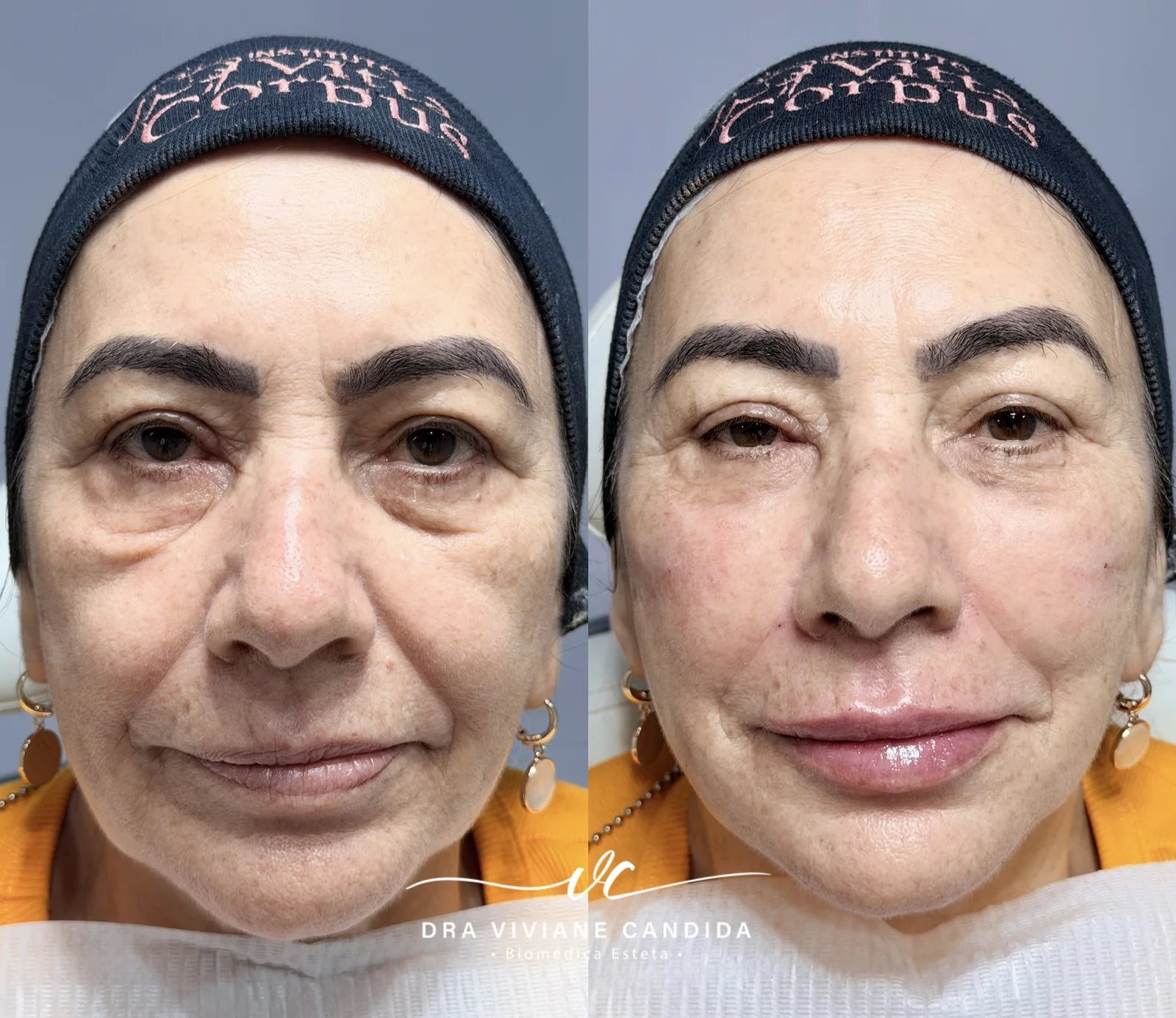 Comparativo de antes e depois do case 2