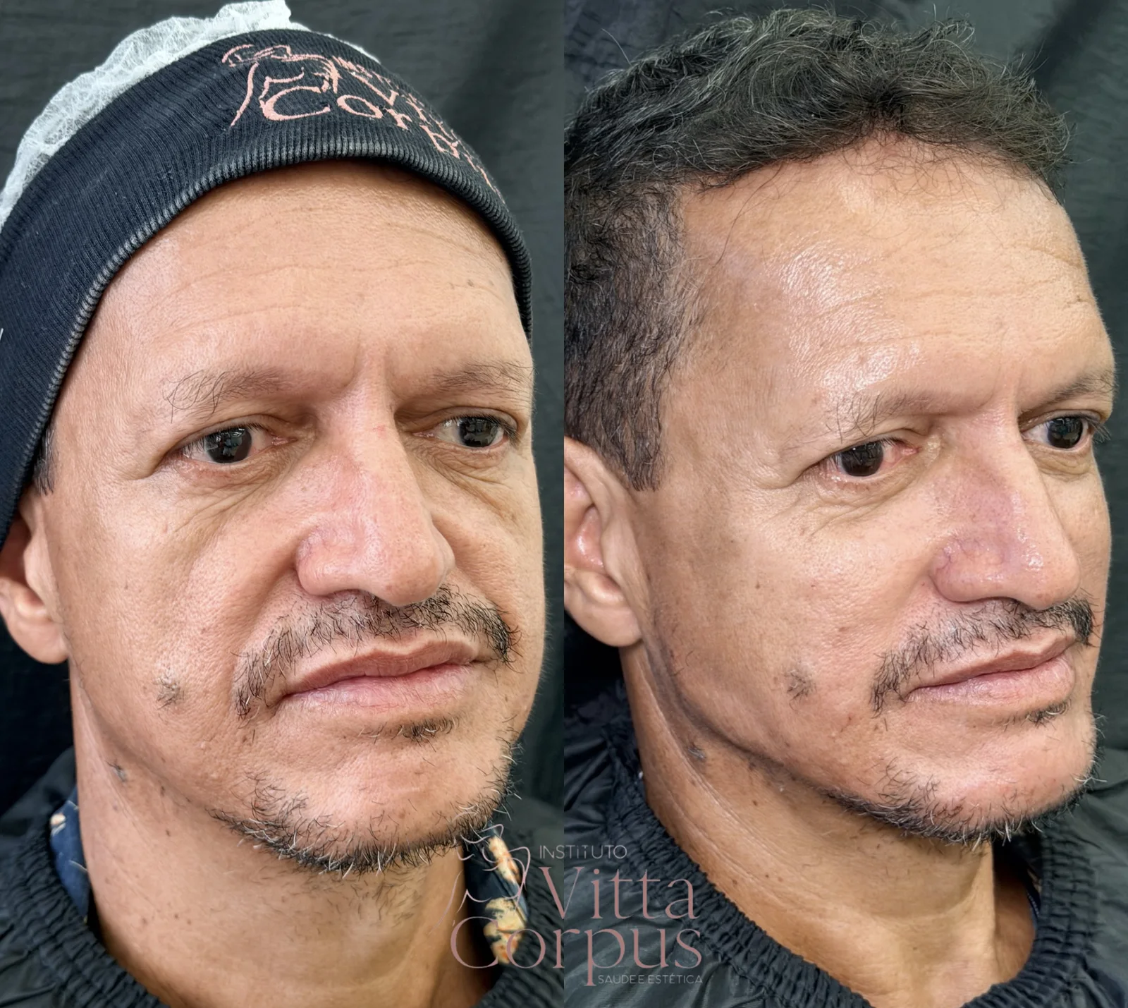 Comparativo de antes e depois do case 3