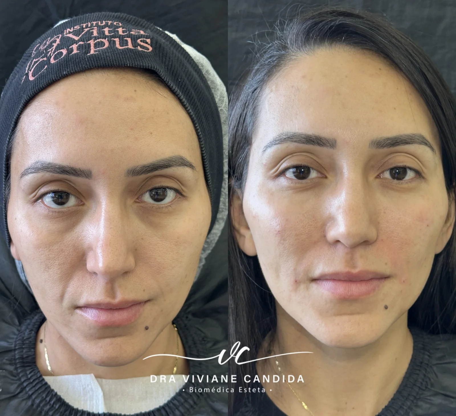 Comparativo de antes e depois do case 5