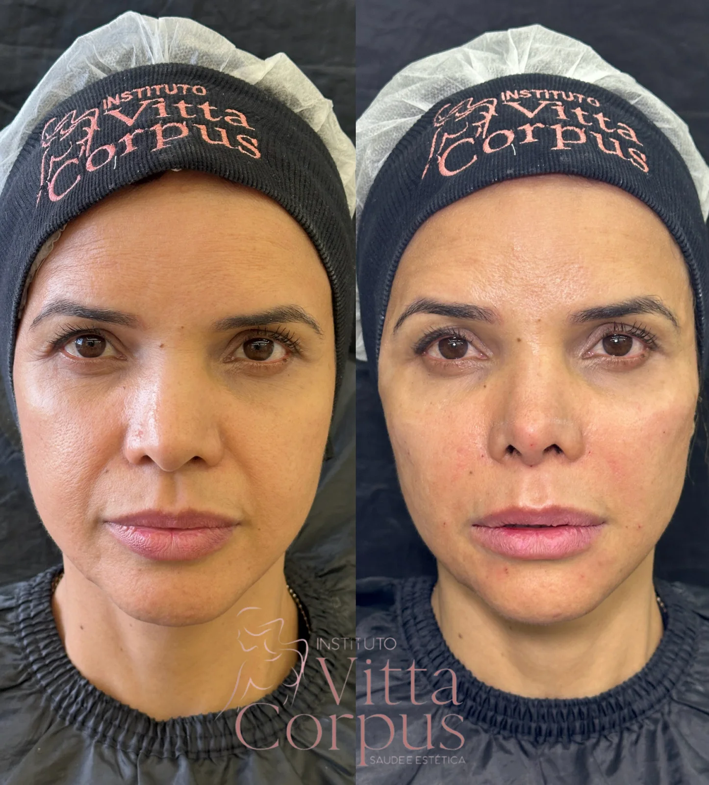 Comparativo de antes e depois do case 6